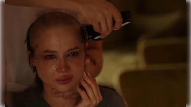 12 фото Лерчек после прохождения химиотерапии, которые обсуждают все